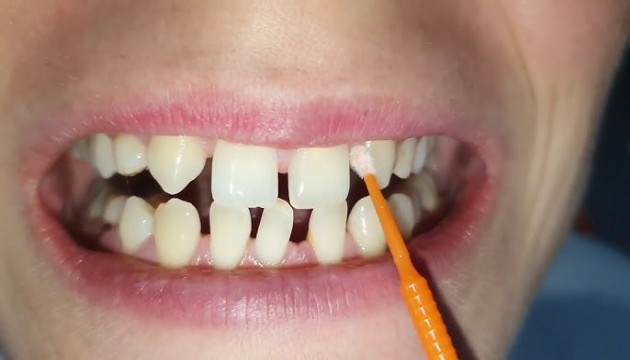 En az 1 dişi eksik 30 erkek aranıyor: İnsanlığı değiştirecek çalışma başladı